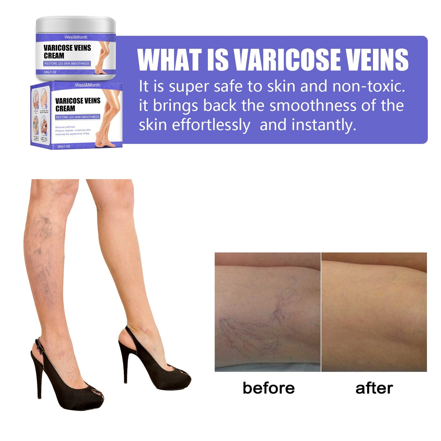 VeinCare Fading Cream